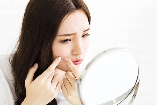 【婚前護膚】簡易2招去痘印 留住最靚moment！