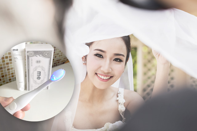 【婚前美白牙齒】3個天然美白牙齒方法 | 編輯親試韓國藝人熱捧「7天見效」藍光美白牙刷